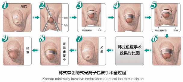 中山健民男科