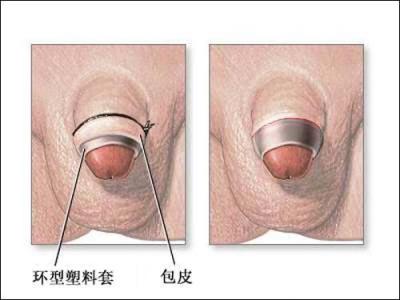 中山东方男科医院